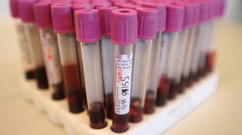 imagen de Los transgénicos son la aceleración de un proceso  “natural” que permite enfrentar los cambios climáticos