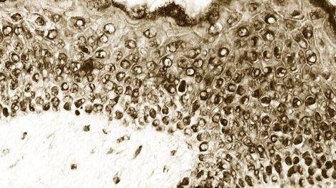 imagen de Ginecólogos insisten en que se realice de forma periódica y gratuita test de HPV en mujeres para mejorar la prevención