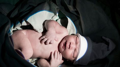 Nacimiento en una maternidad de Montevideo. Foto: Javier Calvelo / adhocFOTOS