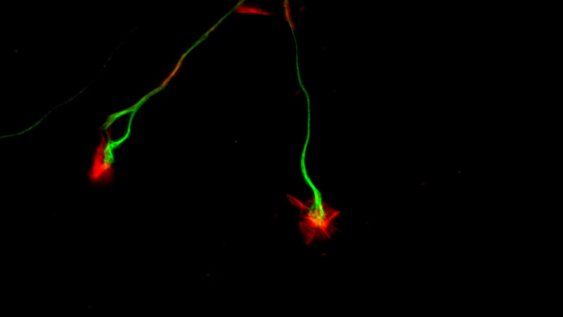 Cono de crecimiento (en rojo) de un axón (en verde) del sistema nervioso simpático observado a gran aumento. Investigación del departamento de Neurofarmacología Experimental sobre los mecanismos celulares y moleculares del desarrollo y funcionamiento del sistema nervioso.&nbsp;