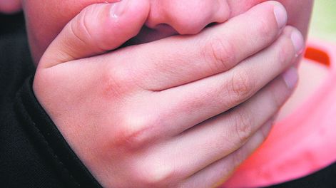 imagen de Problemas odontológicos son motivo de bullying entre los niños