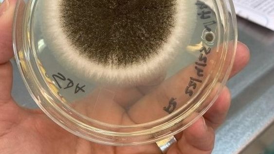 Crecimiento microbiano en medio de cultivo sólido a partir de muestra tomada del aire en salón de escuela. Crecimiento microbiano en medio de cultivo sólido a partir de muestra tomada del aire en salón de escuela.