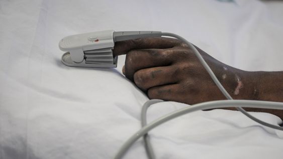 Paciente en el CTI del Hospital Maciel, en 2022 Paciente en el CTI del Hospital Maciel, en 2022