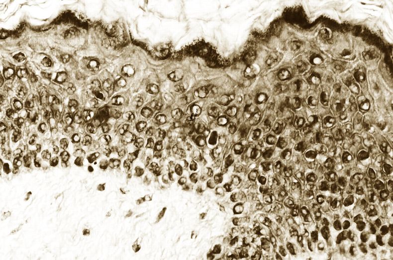 imagen de Ginecólogos insisten en que se realice de forma periódica y gratuita test de HPV en mujeres para mejorar la prevención