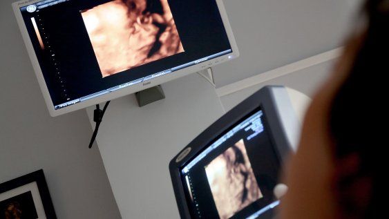 Un estudio de MYSU arrojó que el 56% de las mujeres sufrió algún tipo de violencia obstétrica.