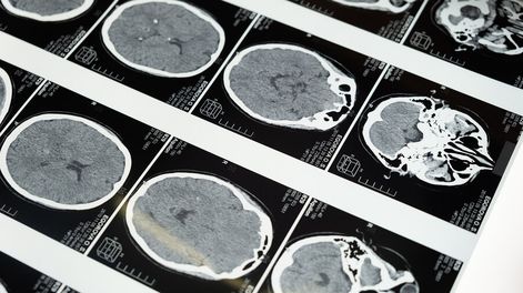 Se extiende en varios países el uso de productos tecnológicos que analizan la actividad cerebral. Foto: Pexels