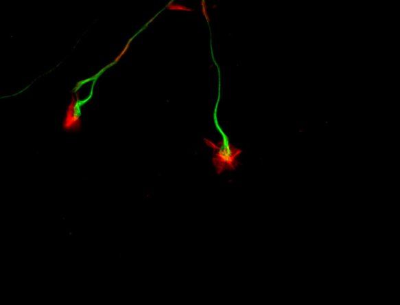 Cono de crecimiento (en rojo) de un axón (en verde) del sistema nervioso simpático observado a gran aumento. Investigación del departamento de Neurofarmacología Experimental sobre los mecanismos celulares y moleculares del desarrollo y funcionamiento del sistema nervioso.&nbsp;