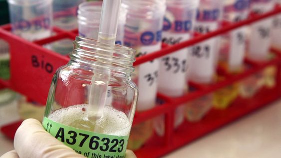 La Agencia Mundial Antidopaje prevé que Uruguay realice modificaciones en los organismos y programas que controlan el dopaje La Agencia Mundial Antidopaje prevé que Uruguay realice modificaciones en los organismos y programas que controlan el dopaje