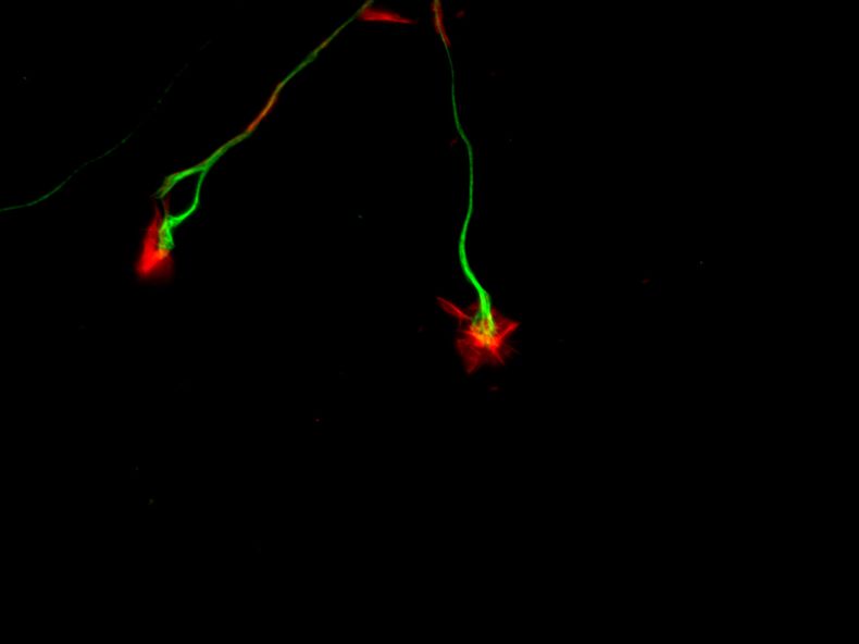 Cono de crecimiento (en rojo) de un axón (en verde) del sistema nervioso simpático observado a gran aumento. Investigación del departamento de Neurofarmacología Experimental sobre los mecanismos celulares y moleculares del desarrollo y funcionamiento del sistema nervioso.&nbsp;