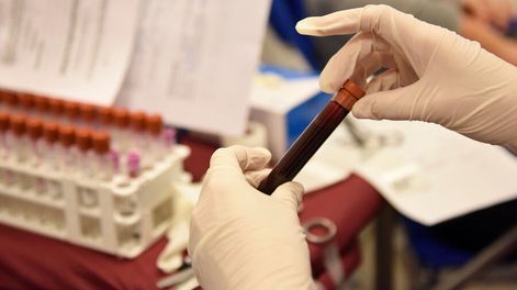 imagen de La biopsia líquida, un método para diagnosticar cáncer que busca  crecer en la región; aún es experimental y mutualistas no lo cubren